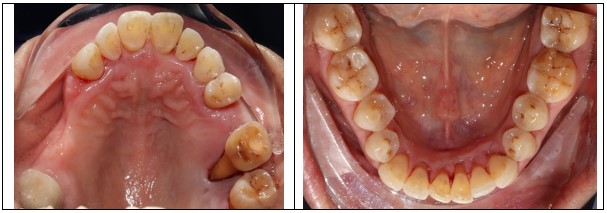 psr quiz case2